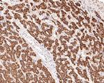 Fumarase Antibody in Immunohistochemistry (Paraffin) (IHC (P))