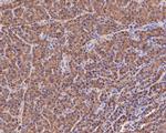 Fumarase Antibody in Immunohistochemistry (Paraffin) (IHC (P))