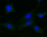 DPP6 Polyclonal Antibody