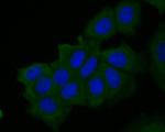 MUC1 Polyclonal Antibody