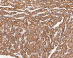 CHRNA3 Antibody in Immunohistochemistry (Paraffin) (IHC (P))