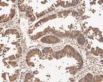 CHRNA3 Antibody in Immunohistochemistry (Paraffin) (IHC (P))
