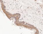 CHRNA3 Antibody in Immunohistochemistry (Paraffin) (IHC (P))