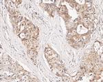 CHRNA3 Antibody in Immunohistochemistry (Paraffin) (IHC (P))