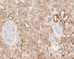 CHRNA3 Antibody in Immunohistochemistry (Paraffin) (IHC (P))