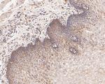 CHRNA3 Antibody in Immunohistochemistry (Paraffin) (IHC (P))