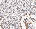 CHRNA3 Antibody in Immunohistochemistry (Paraffin) (IHC (P))
