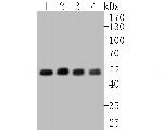 CHRNA3 Antibody in Western Blot (WB)