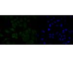 MDM2 Antibody in Immunocytochemistry (ICC/IF)