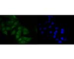 MDM2 Polyclonal Antibody