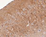 KCNIP1 Polyclonal Antibody