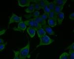 ENT1 Polyclonal Antibody