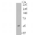 ENT1 Antibody in Western Blot (WB)