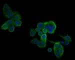 IL18BP Antibody in Immunocytochemistry (ICC/IF)