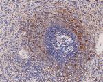 IL18BP Antibody in Immunohistochemistry (Paraffin) (IHC (P))