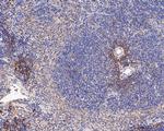 IL18BP Antibody in Immunohistochemistry (Paraffin) (IHC (P))