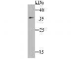 IL18BP Antibody in Western Blot (WB)