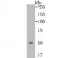ENT1 Antibody in Western Blot (WB)