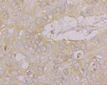 Drebrin Polyclonal Antibody