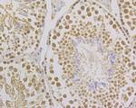 FEN1 Antibody in Immunohistochemistry (Paraffin) (IHC (P))