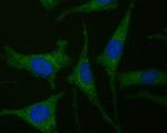 CDK5RAP3 Polyclonal Antibody