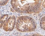 Ki-67 Antibody in Immunohistochemistry (Paraffin) (IHC (P))