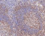 IFITM1 Polyclonal Antibody