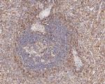 IFITM1 Antibody in Immunohistochemistry (Paraffin) (IHC (P))