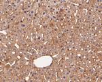Rab11 FIB3 Antibody in Immunohistochemistry (Paraffin) (IHC (P))