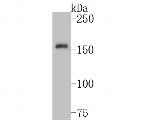 TRPM4 Polyclonal Antibody
