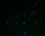 GABRA5 Polyclonal Antibody