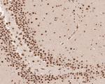 LIM1 Antibody in Immunohistochemistry (Paraffin) (IHC (P))