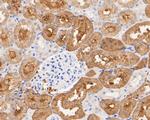 Aldolase B Antibody in Immunohistochemistry (Paraffin) (IHC (P))