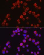 TEC Polyclonal Antibody