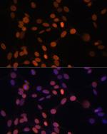 Lamin A/C Polyclonal Antibody