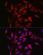 SOCS3 Polyclonal Antibody