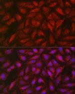 SOCS3 Antibody in Immunocytochemistry (ICC/IF)