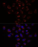 SLC25A1 Antibody in Immunocytochemistry (ICC/IF)