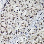 CCNK Polyclonal Antibody