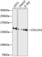 COL11A2 Polyclonal Antibody