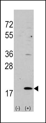 HPCAL1 Antibody in Western Blot (WB)