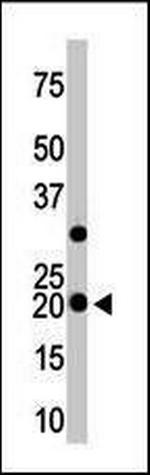HPCAL1 Antibody in Western Blot (WB)