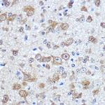 HuD Polyclonal Antibody