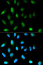 HP1 alpha Antibody in Immunocytochemistry (ICC/IF)