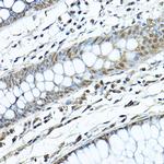 SIRT1 Polyclonal Antibody