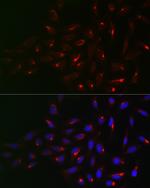 Vimentin Polyclonal Antibody