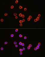 CD64 Polyclonal Antibody