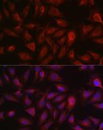 Bax Antibody in Immunocytochemistry (ICC/IF)