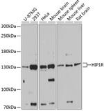 HIP1R Polyclonal Antibody