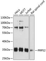 PRPS2 Polyclonal Antibody